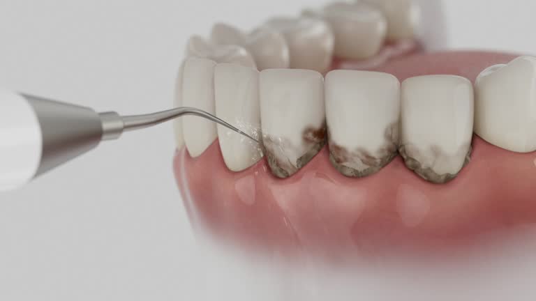 Trusted Teeth Cleaning And Checkup service in Blue Grass, IA - Dentist Open Now